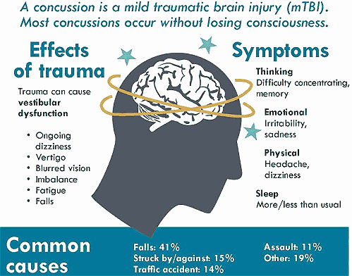 PTSMC concussion-facts