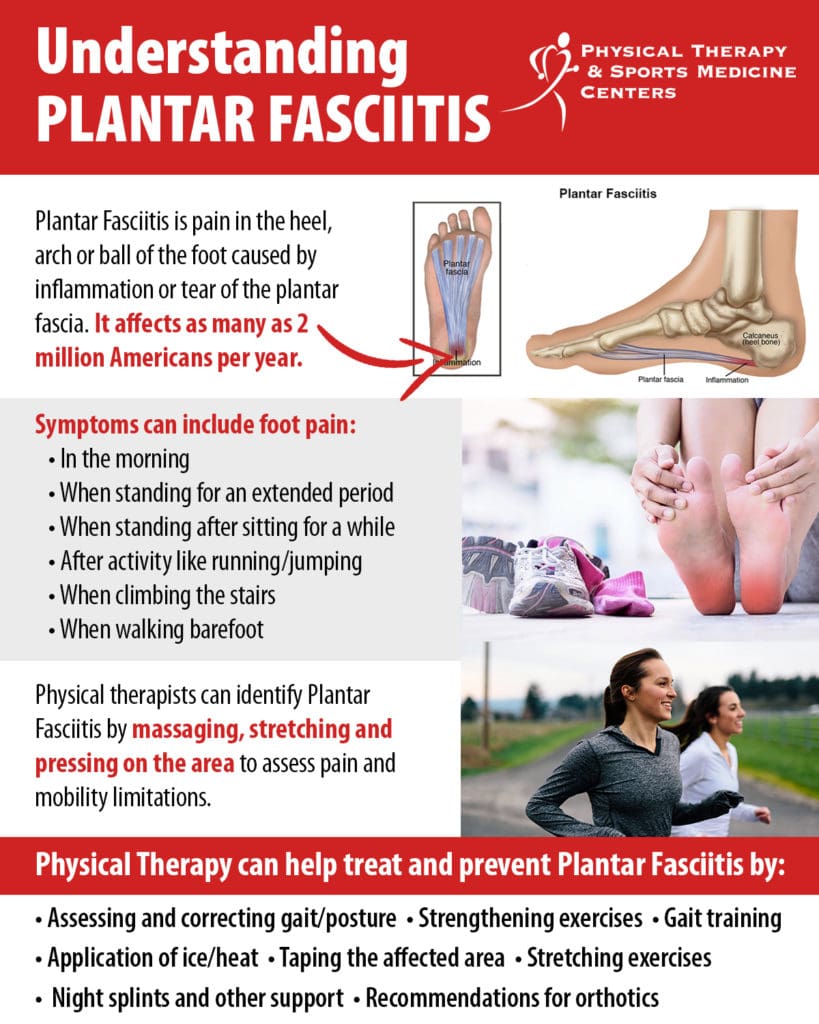 Understanding Plantar Fasciitis | Physical Therapy & Sports Medicine Centers