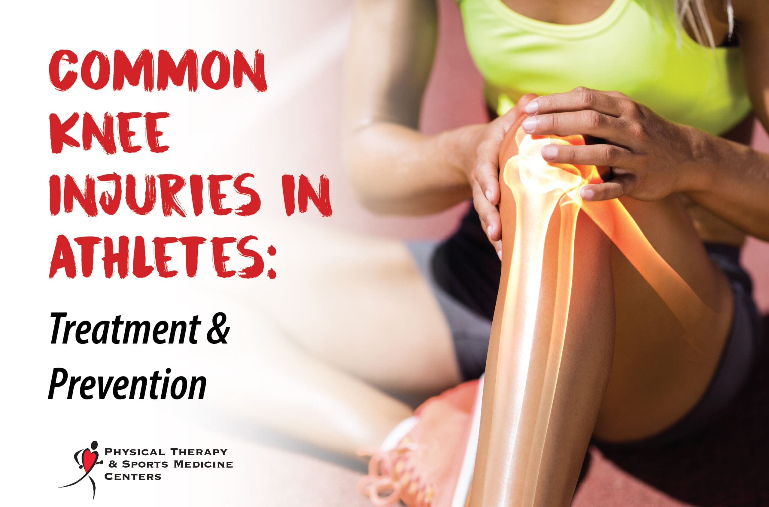 Common Knee Injuries in Athletes Blog Post Graphic